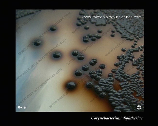 C.diphtheriae cystinase activity on Tinsdale agar, after 48 hours corynebacterium diphtheriae surrounded by black halo on Tinsdale agar